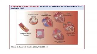 Anticoagulation Post Stroke: Who, What, When?