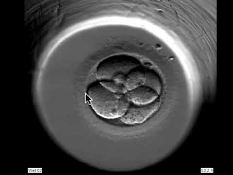 Видео: Какво е ембрион, обсъждаме развитието на двуколен ембрион?