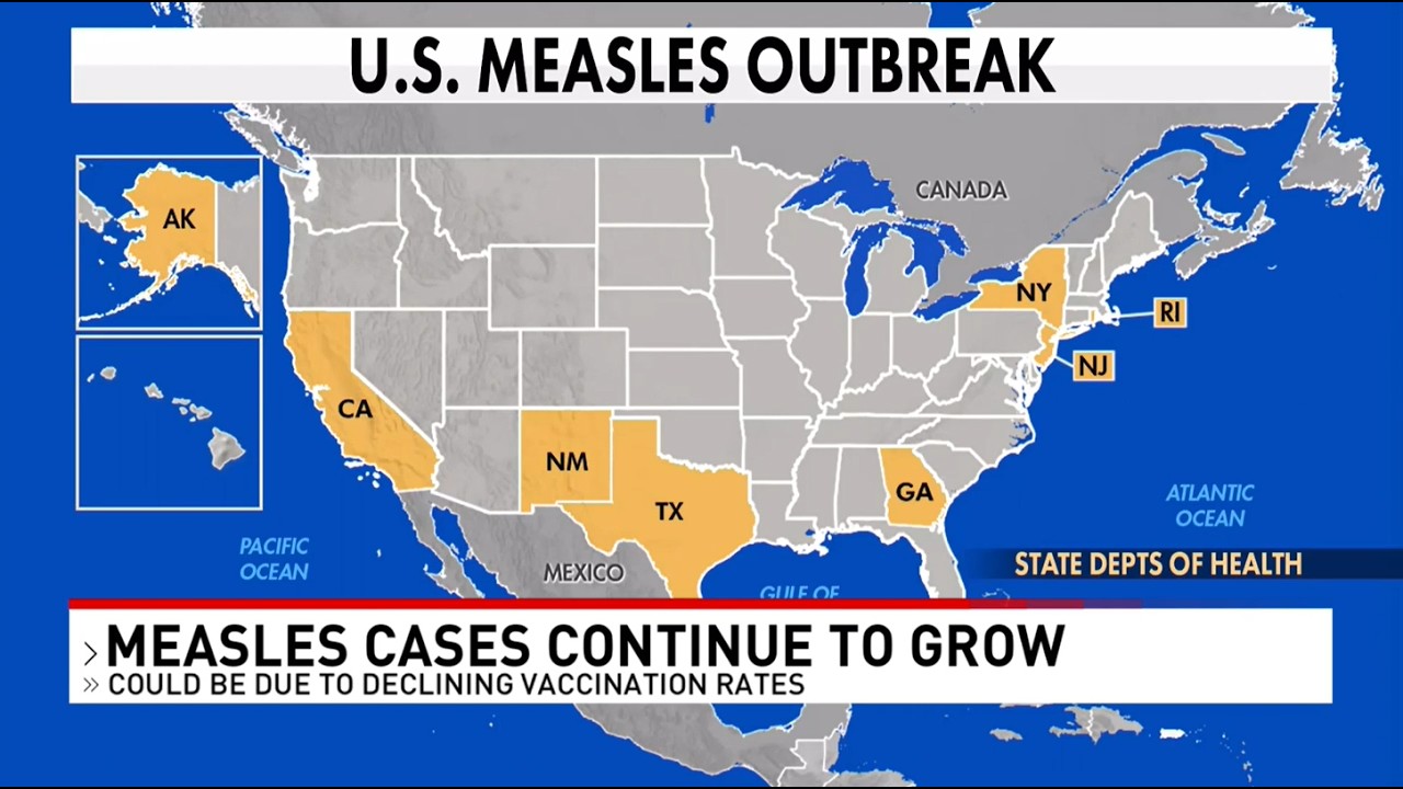 Measles cases continue to grow in Texas, what you need to know - YouTube