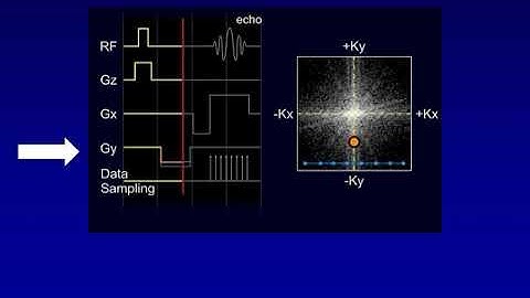 MRI Physics   Supplement 1b   Aliasing and Parallel Imaging    Kucharczyk