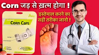 Apex Cornheal Corn Caps Review , Benefits & How To Use | Corn Caps