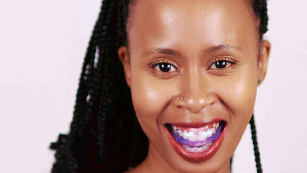 How Alidon Works | Universal Teeth Alignment Kit