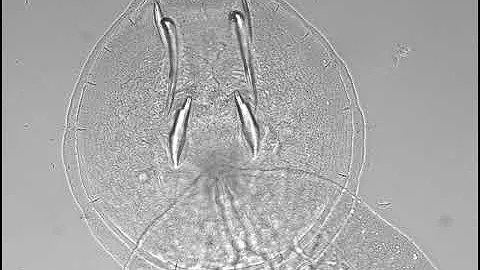 Прикрепительный диск моногенеи (Monogenea, Capsalidae).