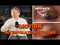 Unnatural TV motion, soap opera effect, stuttering and artifacts? Adjust THIS on your TV!