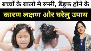 बच्चों के बालो मे रूसी, डैंड्रफ होने के कारण लक्षण और घरेलु उपाय। Dandruff in kids | Home Remedies