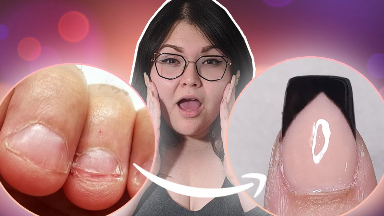 Easy Way To Fix Short Bitten Nails With Acrylic YouTube easy-way-to-fix-short-bitten-nails-with-acrylic-youtube