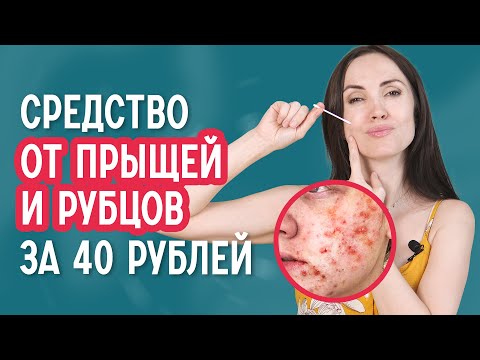 Дешёвое и эффективное средство от прыщей, акне и рубцов