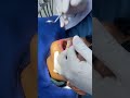 Brace adjustment and repair process #braces #orthodontist #dental