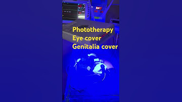 newborn #phototherapy # with eye and genitalia cover #babycare #neonatal jaundice#nicu