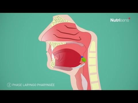 Vidéo: Quand la trachée est bloquée ?