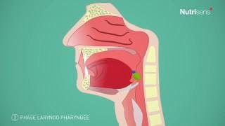 Dysphagie Troubles De La Dégluion Et Fausse Route, Quest-Ce Que Cest ?