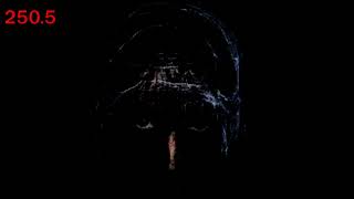 Mr Incredible Becoming Uncanny Phases 210-300 By D Xd Archive