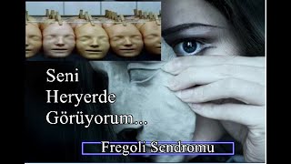Fregoli (Binbirsurat) Sendromu