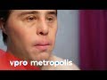 Plastic surgery with down syndrome in Spain - vpro Metropolis