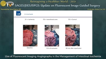 Use of Fluorescent Imaging Angiography in the Management of Intestinal Isschemia