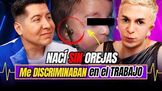 ¡NACÍ SIN OREJAS!👂| TENGO SÍNDROME de TREACHER COLLINS | #Diagnóstico 59 | Mr Doctor