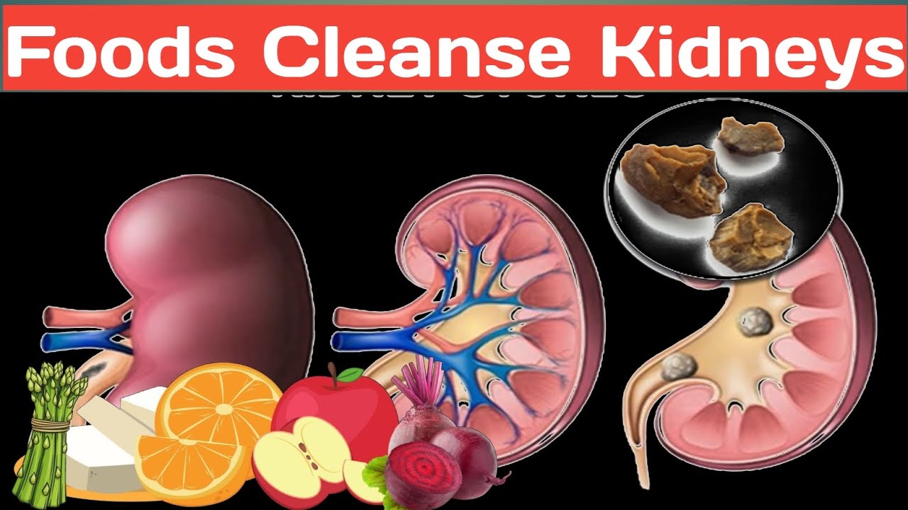 7 FOODS That Will CLEANSE Your Kidneys FAST! - YouTube