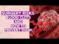 Having surgery dr rahal explains the risks of blood clots and how to prevent them