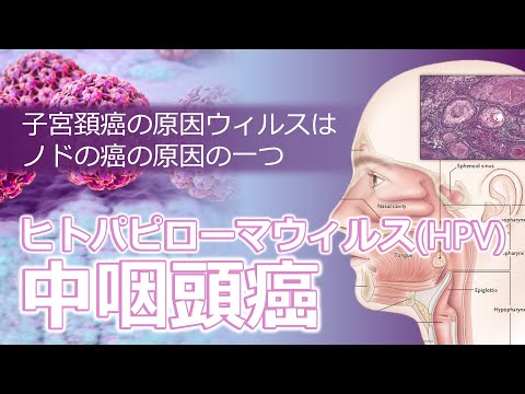 ヒトパピローマウィルス(HPV)と中咽頭癌