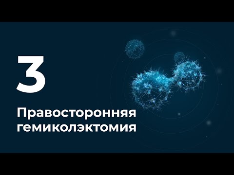 Правосторонняя гемиколэктомия 1 (Видео 3)