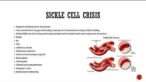Sickle Cell Anemia Video