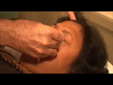 Vidéo: Acupuncture Et Moxibustion Pour Les Troubles Liés Au Stress