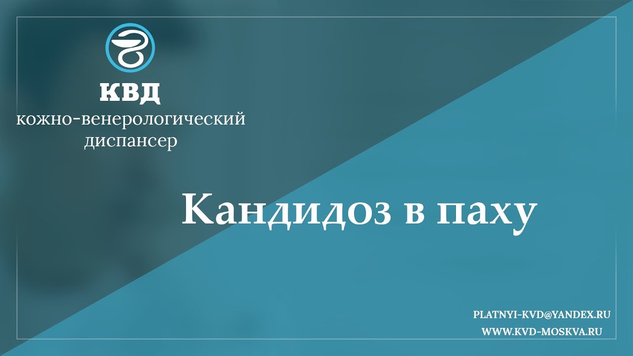 814 Кандидоз в паху