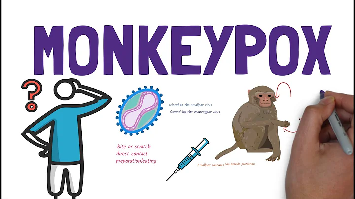 What is Monkeypox? | A quick overview - DayDayNews