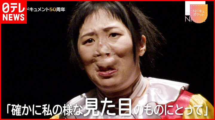 【NNNドキュメント】顔面の"奇形"  見た目の悩みを乗り越え掴んだ幸せ　NNNセレクション