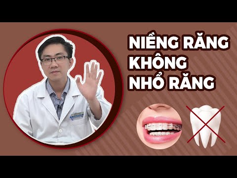 chăm sóc răng khi niềng tại Kemtrinam.vn