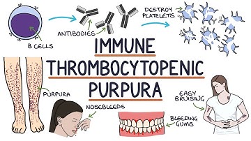 Understanding Immune Thrombocytopenic Purpura - ITP