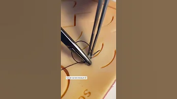 Самая частая операция  / Most frequent surgery