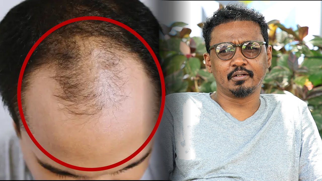 Bisle “ragga bidaarta leh iyo dumarka bidaarta leh waxaa badan dumarka ...