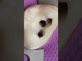 Root canal procedure all steps in 4k tooth restoration shorts