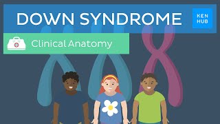 Down Syndrome: Definition, causes, symptoms, diagnosis  | Kenhub