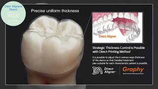 Clear Aligners direct with Graphy