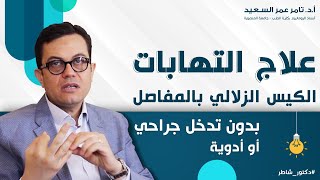 الكيس_الزلالي بالركبة | طرق العلاج والفرق بين جلطات الساق والأكياس الزلالية | أ.د. تامر عمر السعيد#