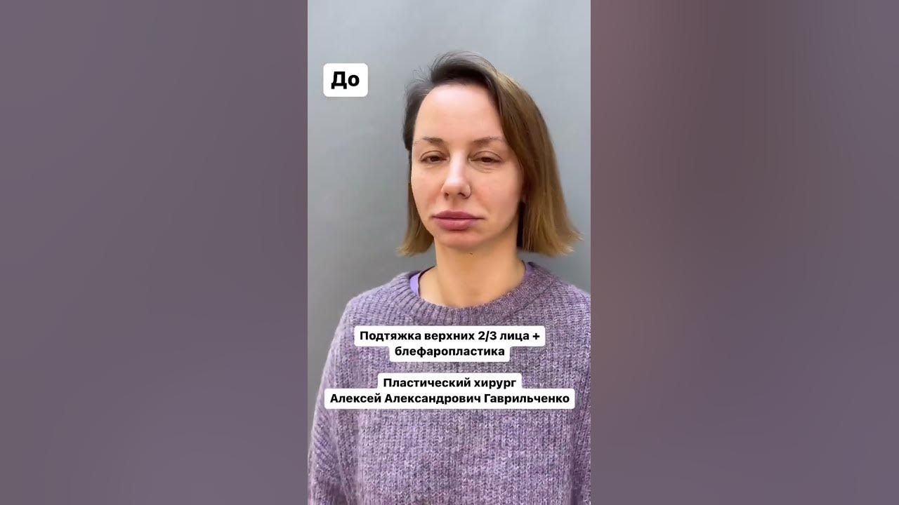 Клиника дега юсупова результаты фото Гаврильченко пластический хирург