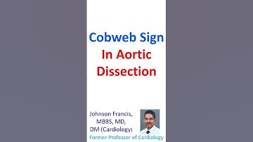 Cobweb sign in aortic dissection
