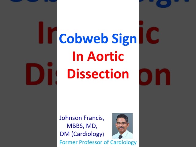 Cobweb sign in aortic dissection class=