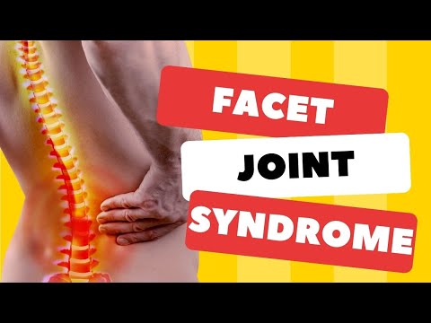 Top 3 Signs Your Back Pain is Facet Joint Syndrome-Symptoms & Signs