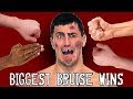 BIGGEST BRUISE WINS - Hand Strikes VS Human Flesh Contest | Bodybuilder VS Normal Guy Competition