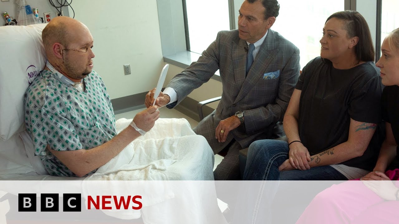 US veteran gets world’s first eye transplant – BBC News