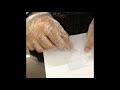 Scabies mite extraction