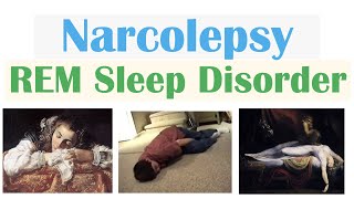 Narcolepsy (Sleep Disorder) | Causes, Pathophysiology, Signs & Symptoms, Diagnosis, Treatment