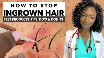 How to Stop Ingrown Hair & Razor Bumps from Waxing & Shaving | Treatments & Products | Black Skin