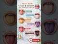 What Your Tongue Color Says About Your Health 👅⚠️ #youtubeshorts