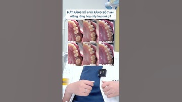 MẤT RĂNG 7 CÓ NIỀNG ĐƯỢC KHÔNG? #niềng_răng #dentist