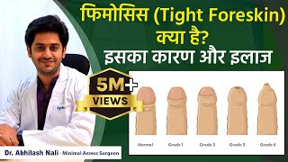 How to Deal with Phimosis? || Phimosis Symptoms and Treatment in Hindi || Dr Abhilash Nali