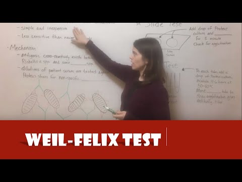 Video: Miks Weil Felixi test tehakse?